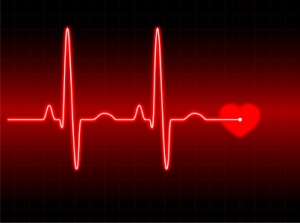 EKG
